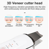 Elizabeth Treasures Deep Clean Ultrasonic Skin Scrubber